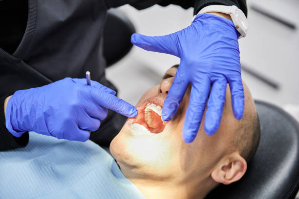 Best Emergency Treatment for Toothache in Newark, TX